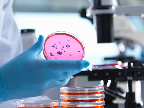 Scientist holding a petri dish