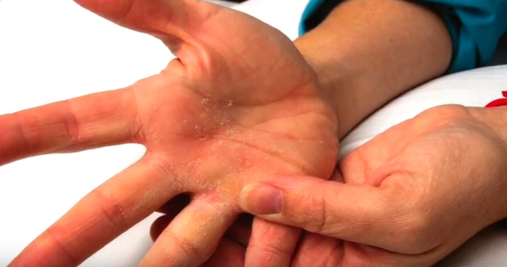 Close up of peeling hands