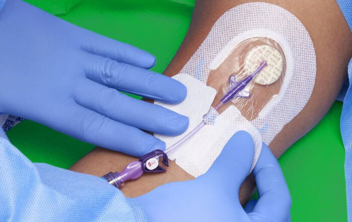 Medline Contour SorbaView SHIIELD Integrated Securement Dressing