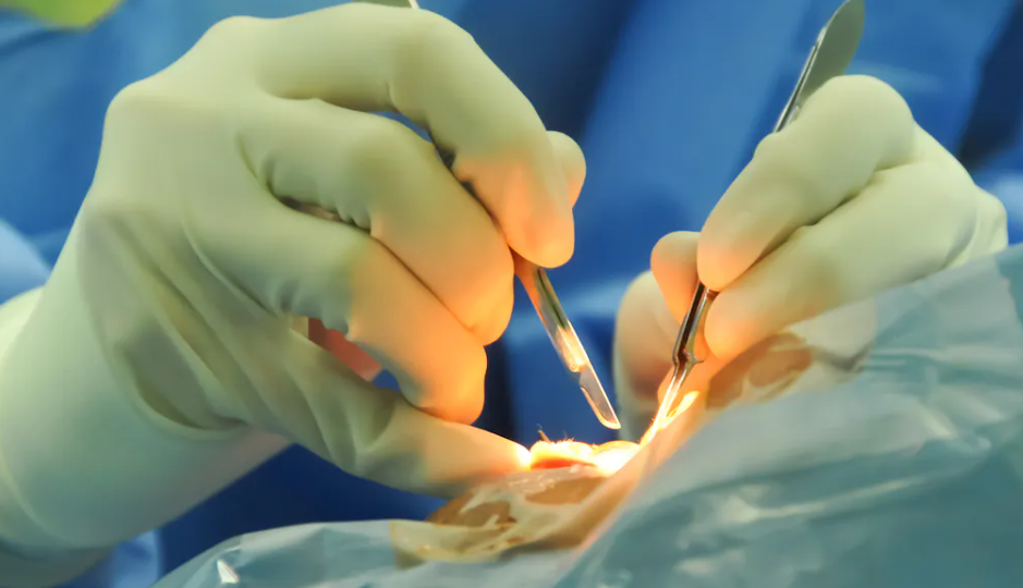 HPN SSI HAI prevention